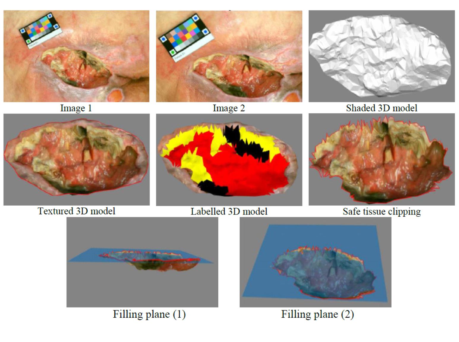 3d image of wound